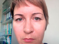 Фото 1. Как избавиться от нависших век?