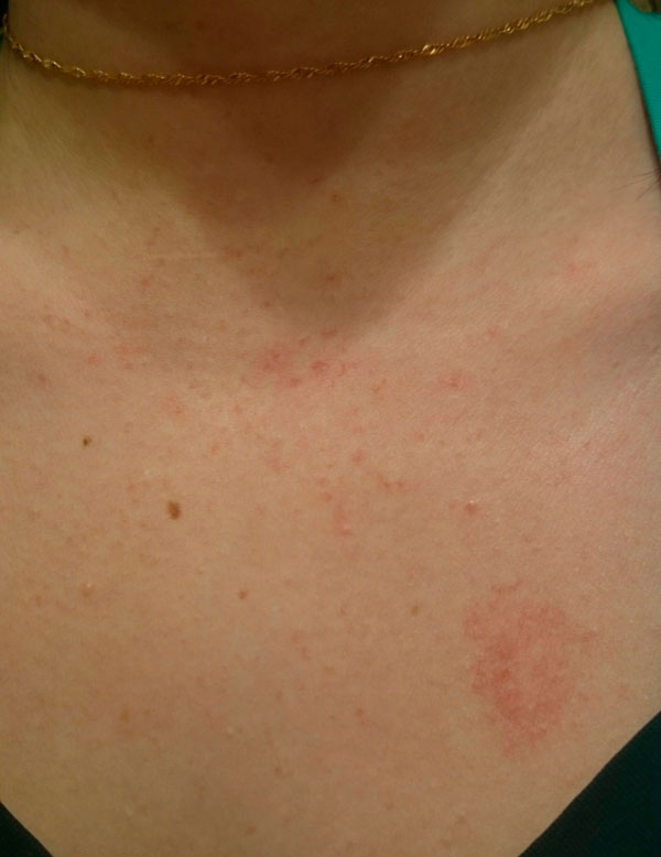 Фото 1. Сосудистые образования