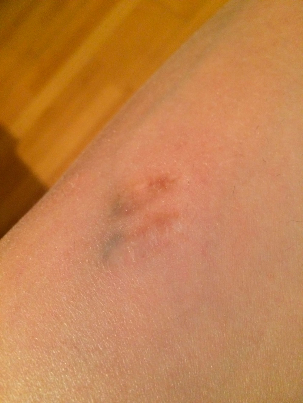 Фото 1. шрамы