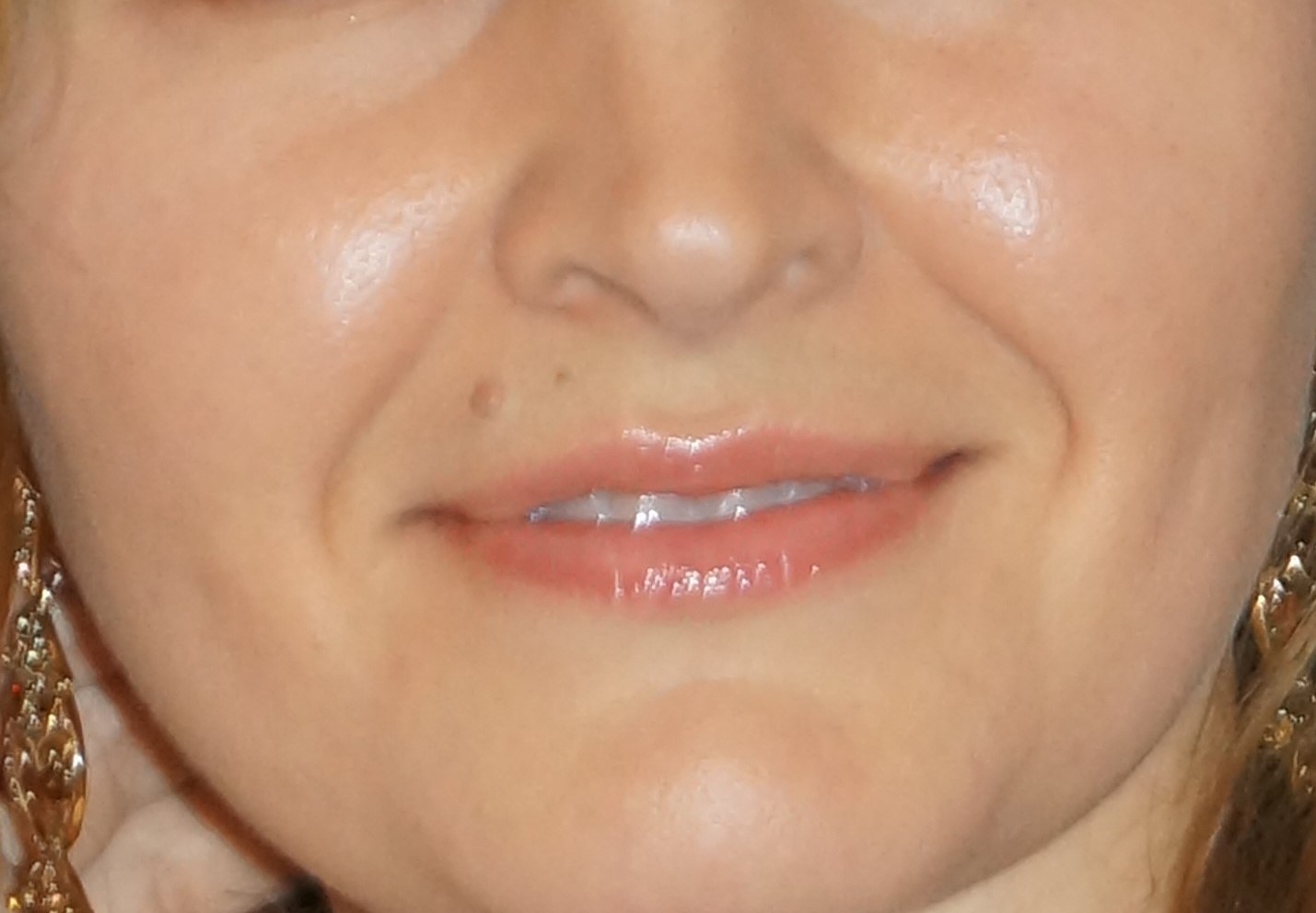 Фото 1. Процедуры омоложения при киллоидах