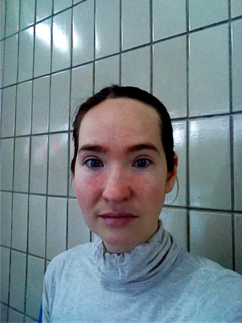 Фото 1. Сухость кожи.