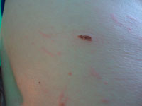 Фото 1. Беспокоюсь из-за родинки