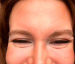 Фото 3. Беспокоит кожа нижних век