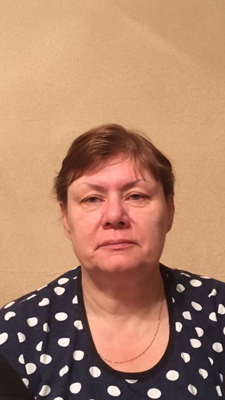 Фото 1. Обвисли веки. Ищу врача в Уфе.