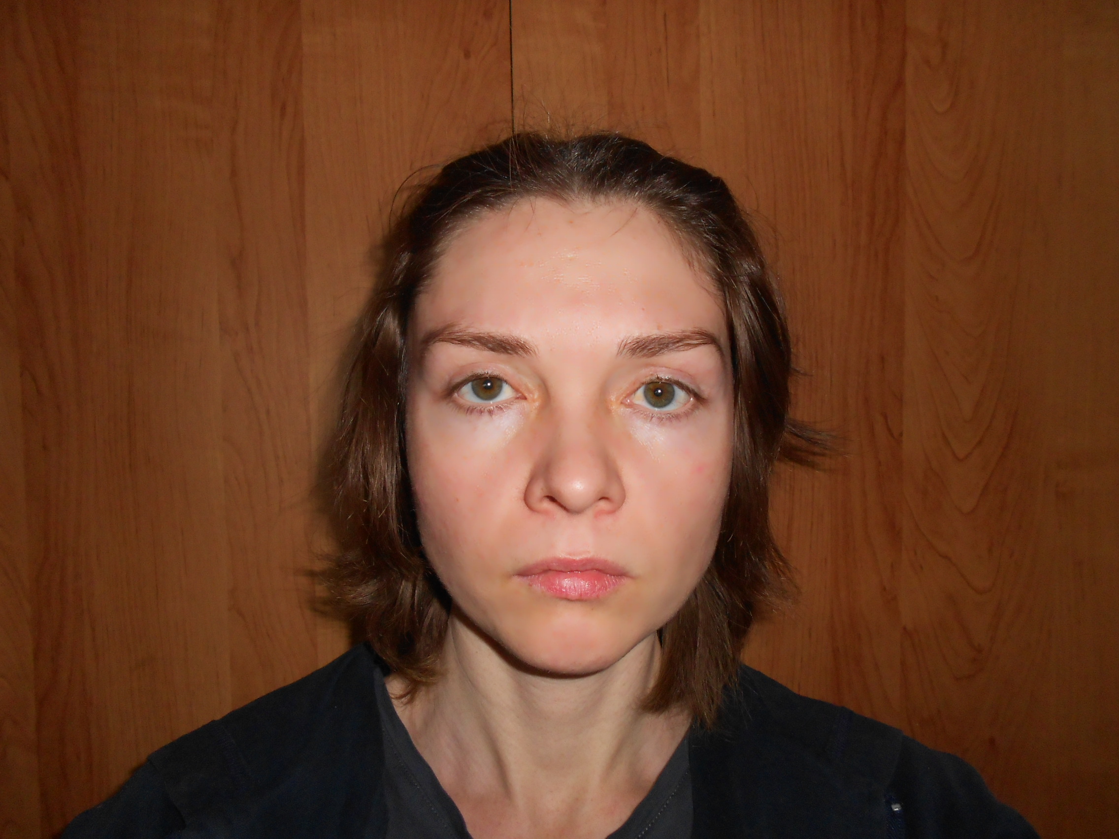 Фото 1. Поднятие брови