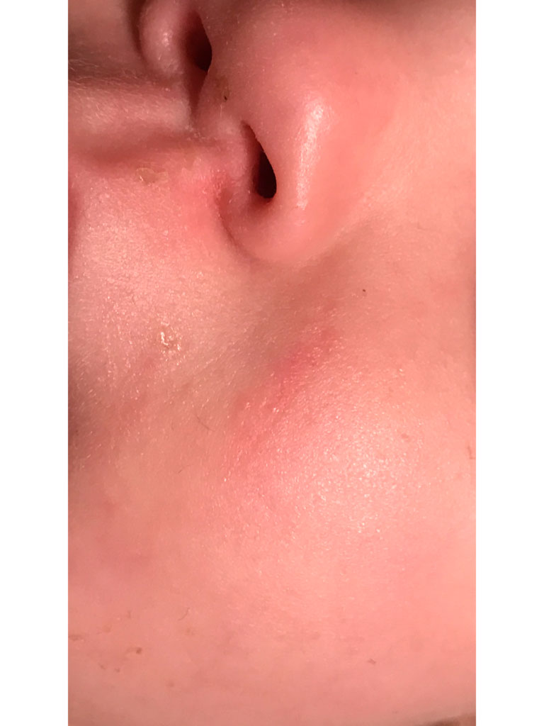 Фото 2. Зажило с маленькой 