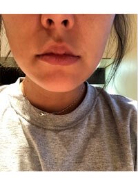 Фото 2. Что посоветуете от второго подбородка?