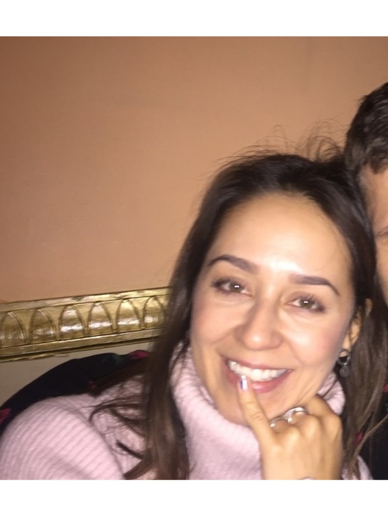 Фото 3. Ювидерм в носослезные борозды