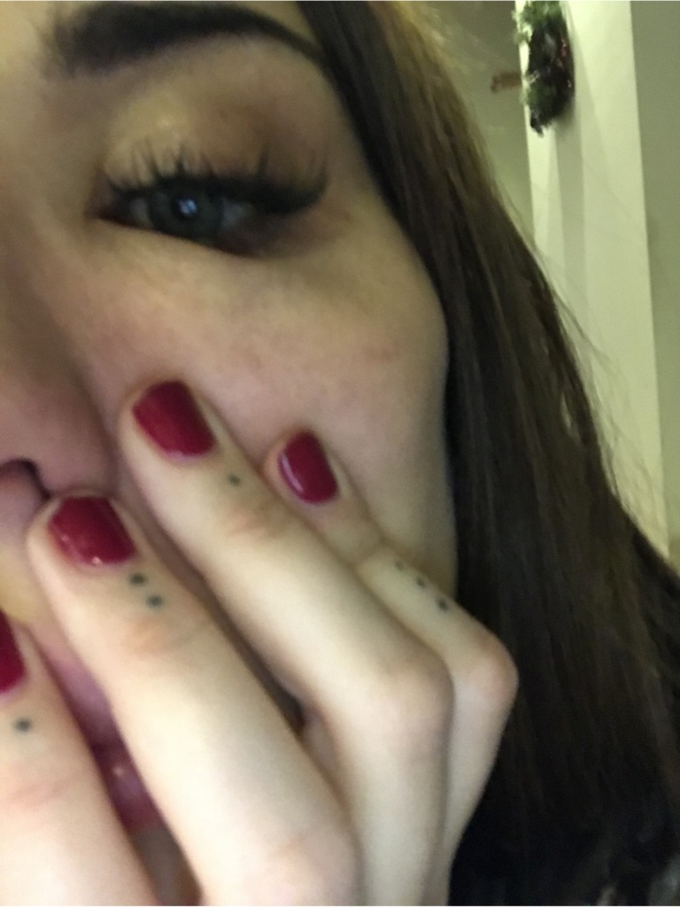 Фото 1. Осложнение после Радиесс и Волбелла при ангине