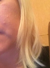 Фото 1. Начали появляться светлые родинки на лице
