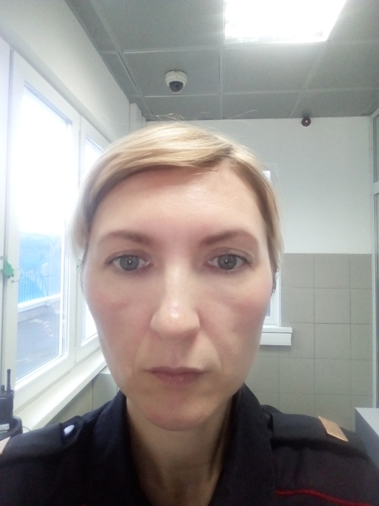 Фото 1. Можно ли убрать носогубки увеличением  скул?