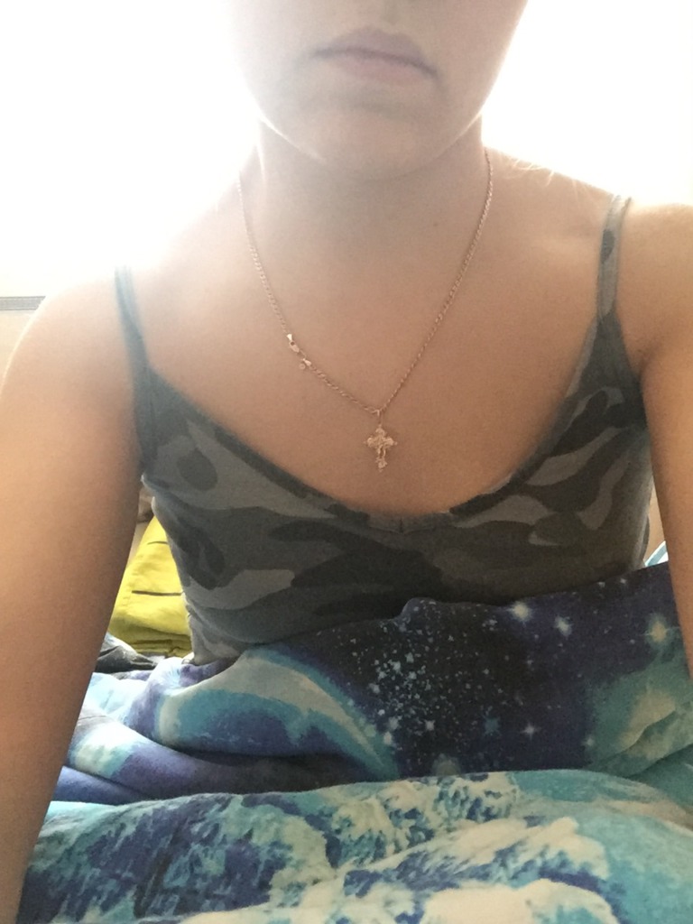 Фото 1. Сделали уколы Ксеомина при цервикальной дистонии