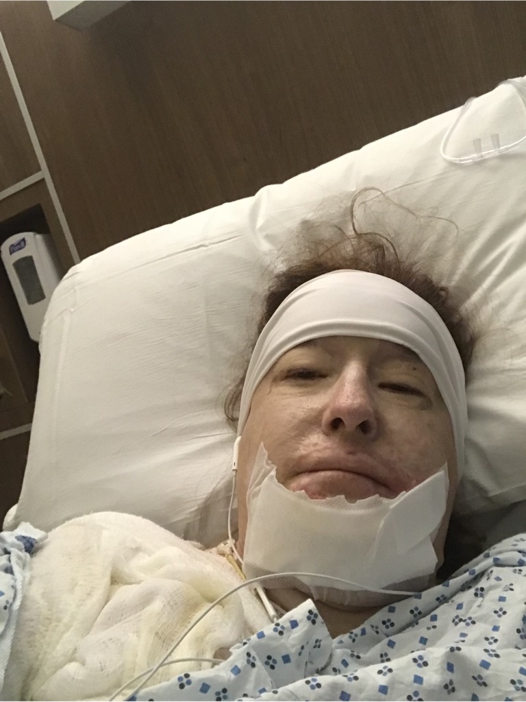 Фото 3. Стоит ли провести повторную операцию на нижнем веке, чтобы убрать ощущение вывернутости и красноту?