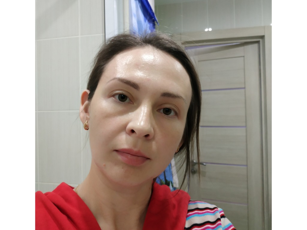 Фото 2. Как избавиться от заломов на лице и мешков под глазами?
