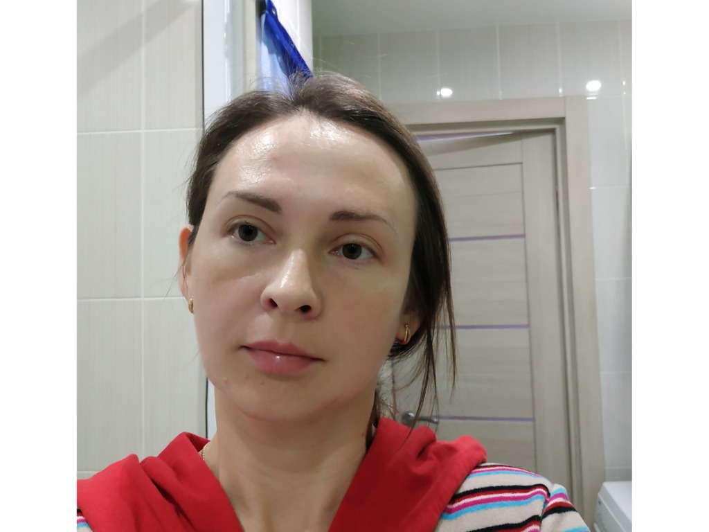 Фото 1. Как избавиться от заломов на лице и мешков под глазами?