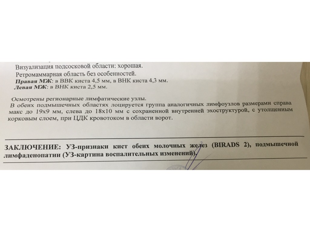 Фото 1. Являются ли кисты молочных желез противопоказанием к пластике груди?