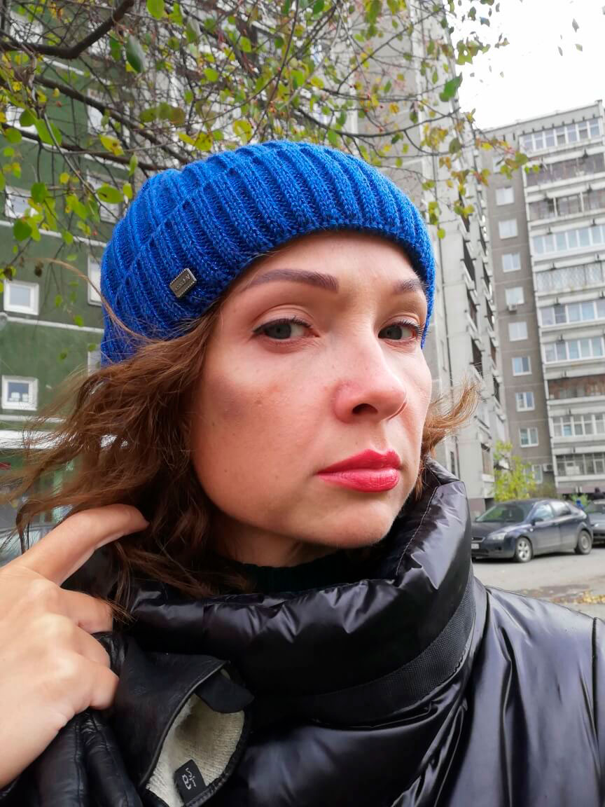 Фото 1. Какой метод эффективнее? Филлер на скулы или векторный лифтинг?