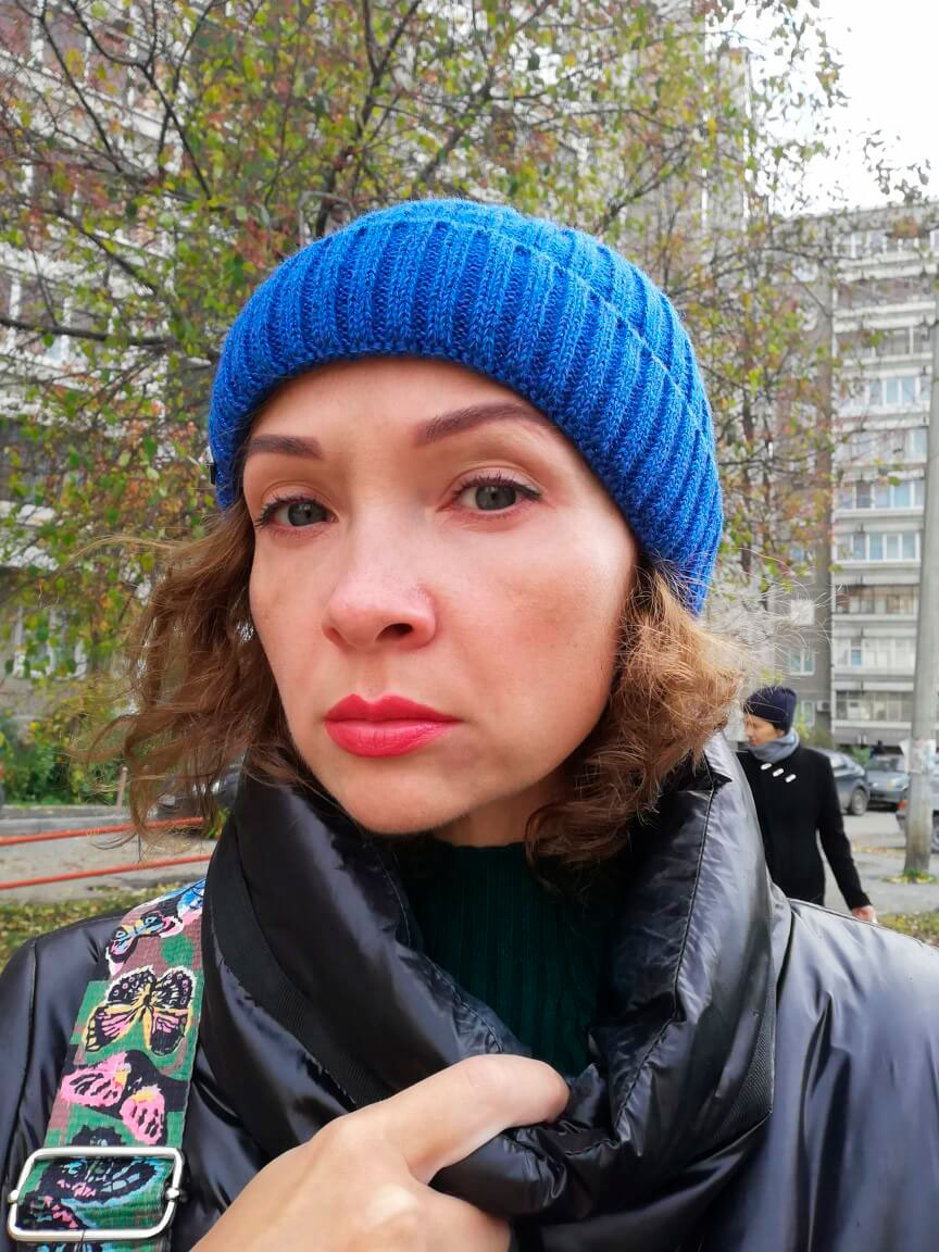 Фото 3. Какой метод эффективнее? Филлер на скулы или векторный лифтинг?