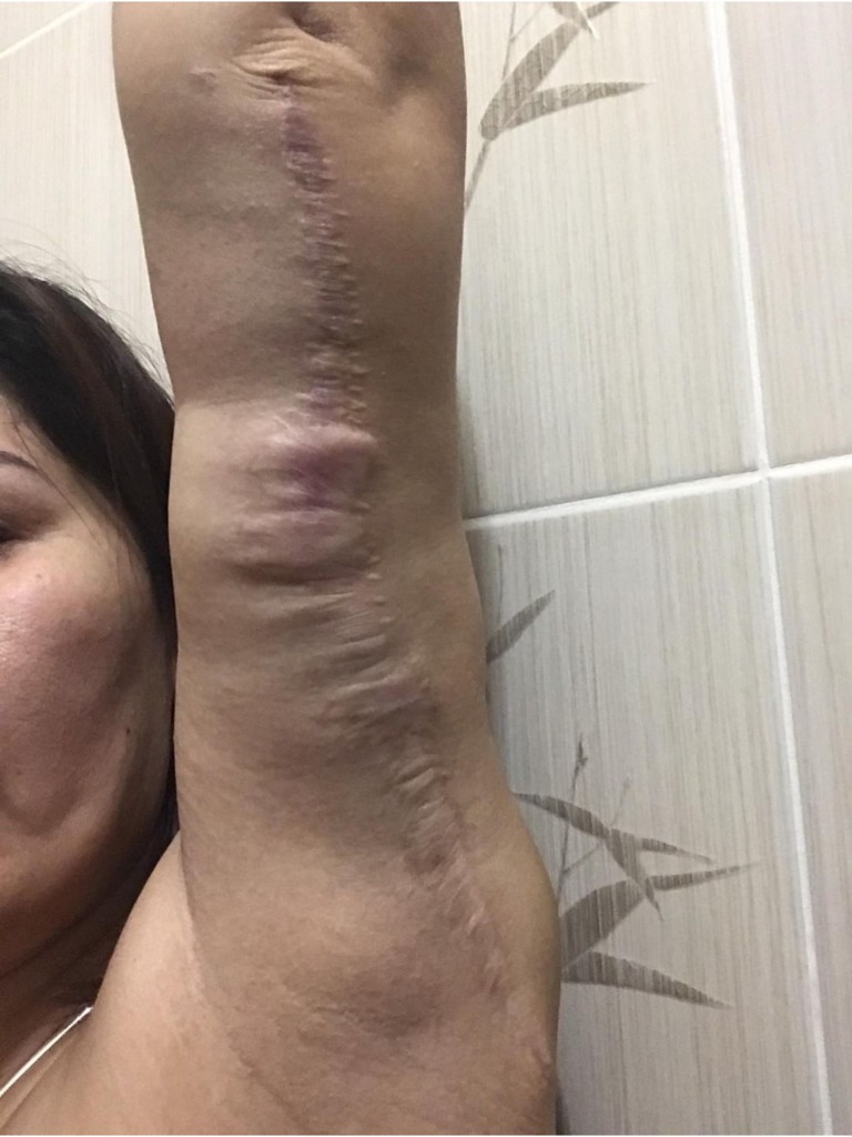 Фото 3. Как можно исправить такую ситуацию после брахиопластики?