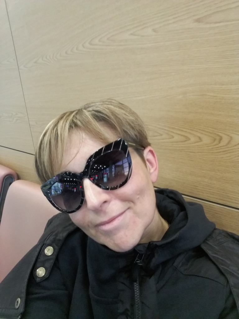 Фото 1. Полгода не проходят папулы после биоревитализации