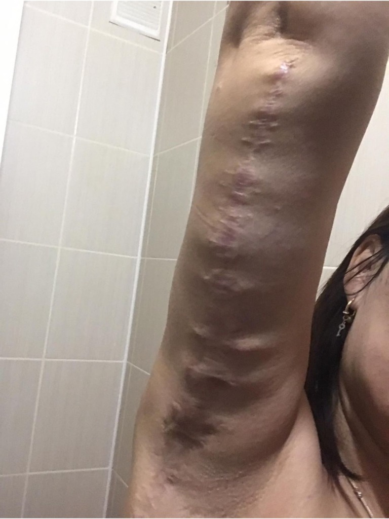 Фото 1. Как можно исправить такую ситуацию после брахиопластики?