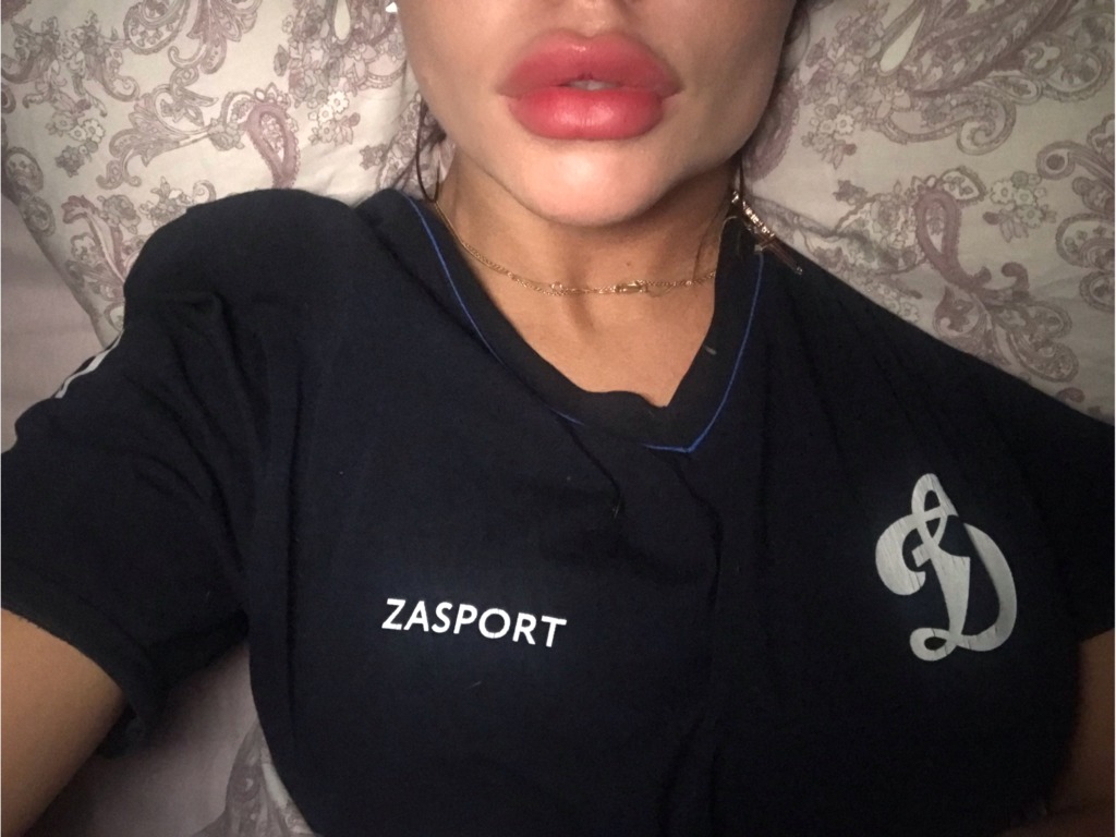 Фото 1. Как убирать воспаления спустя полгода?