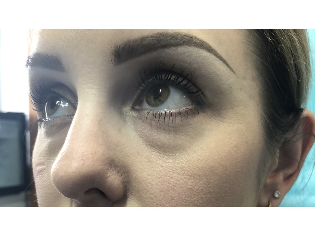 Фото 1. Почему появились отеки и как их убрать?