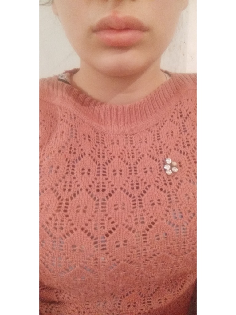 Фото 1. Уберет ли гель ревалакс лонгидаза?