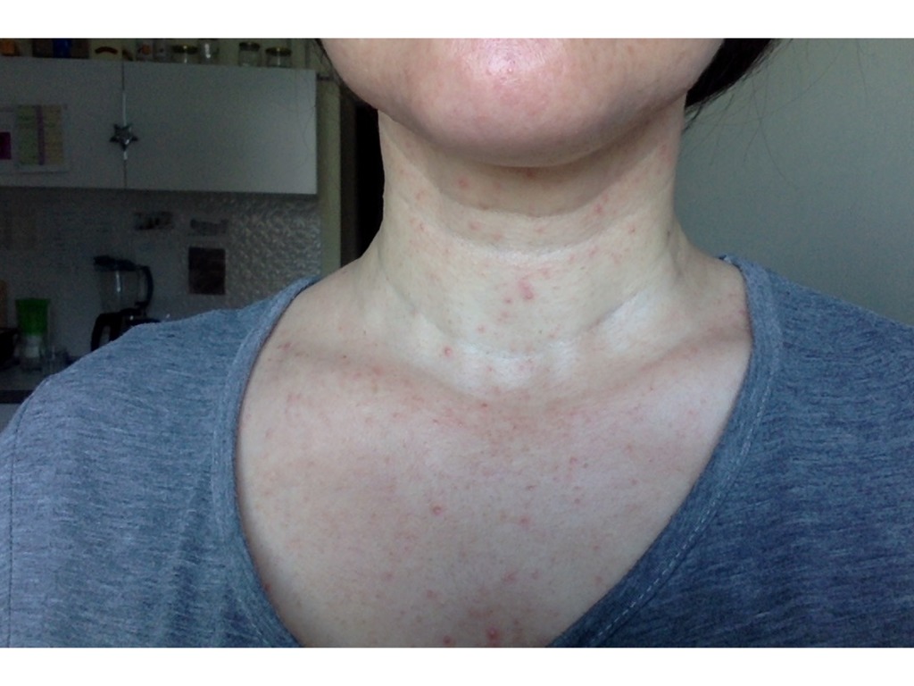 Фото 1. Как решить плохое состояние шеи?