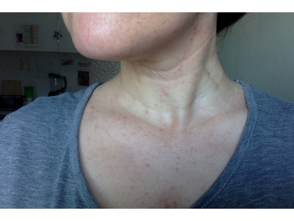 Фото 3. Как решить плохое состояние шеи?