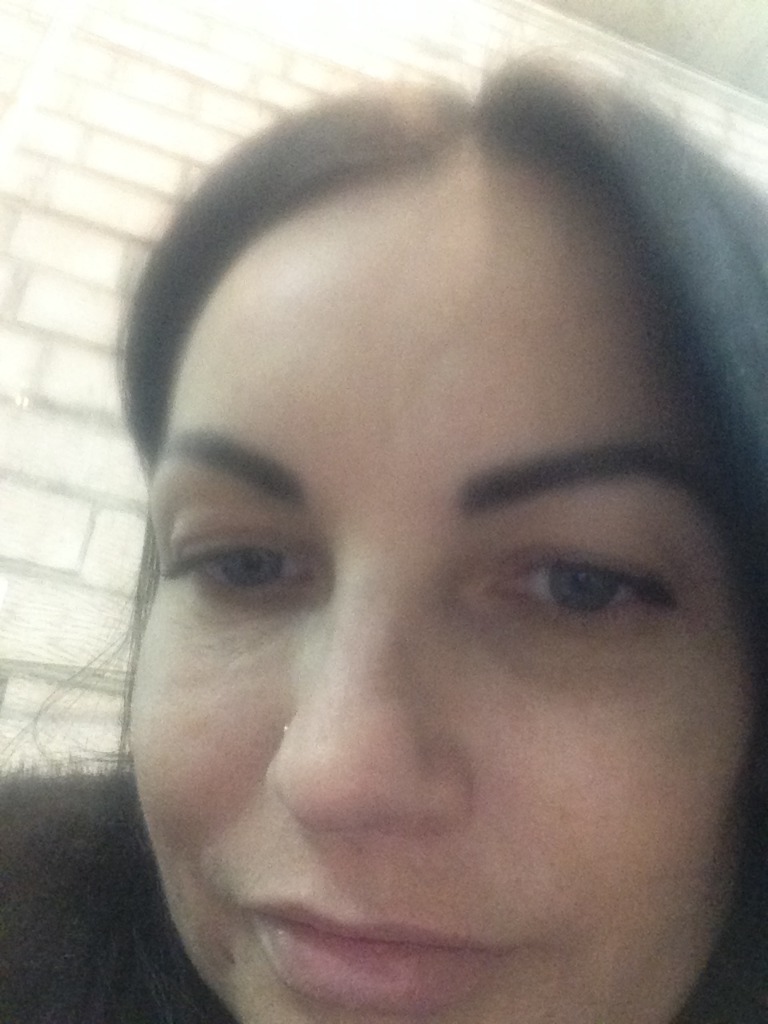 Фото 1. Как можно удалить белотеро баланс из носослезной борозды?