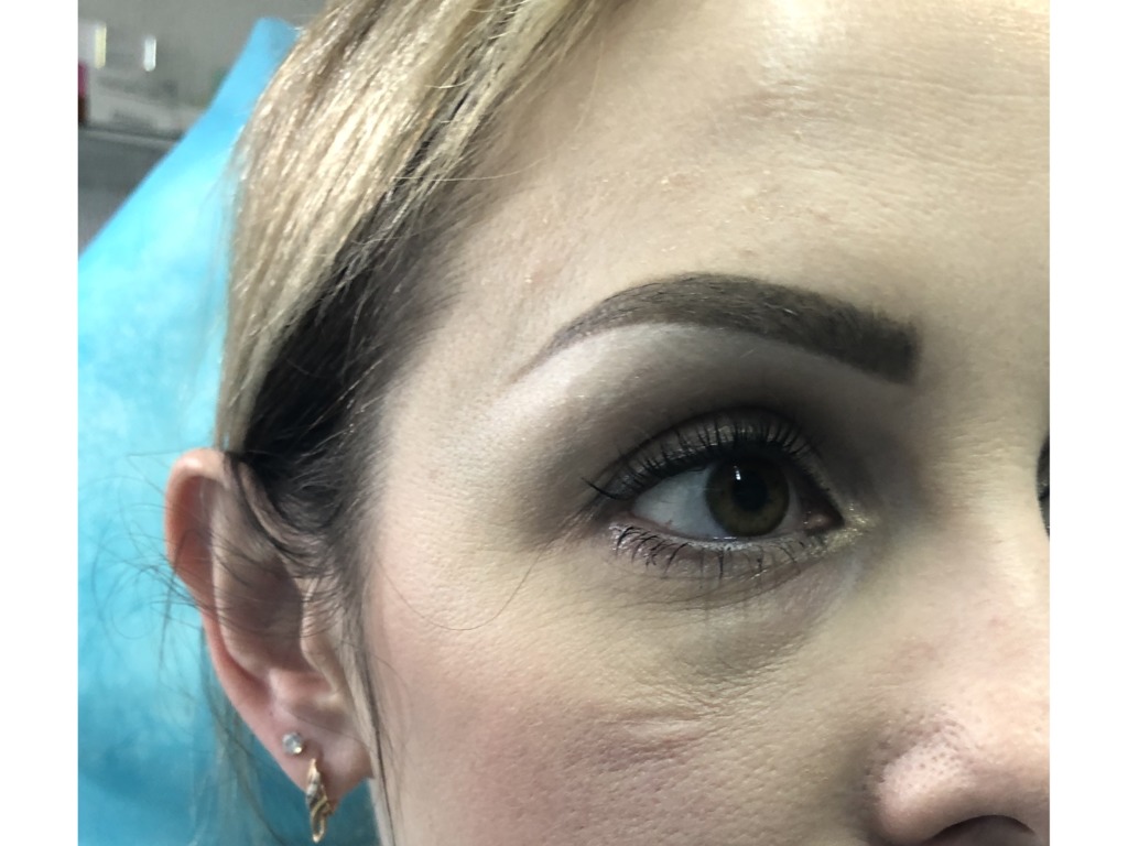 Фото 3. Почему появились отеки и как их убрать?