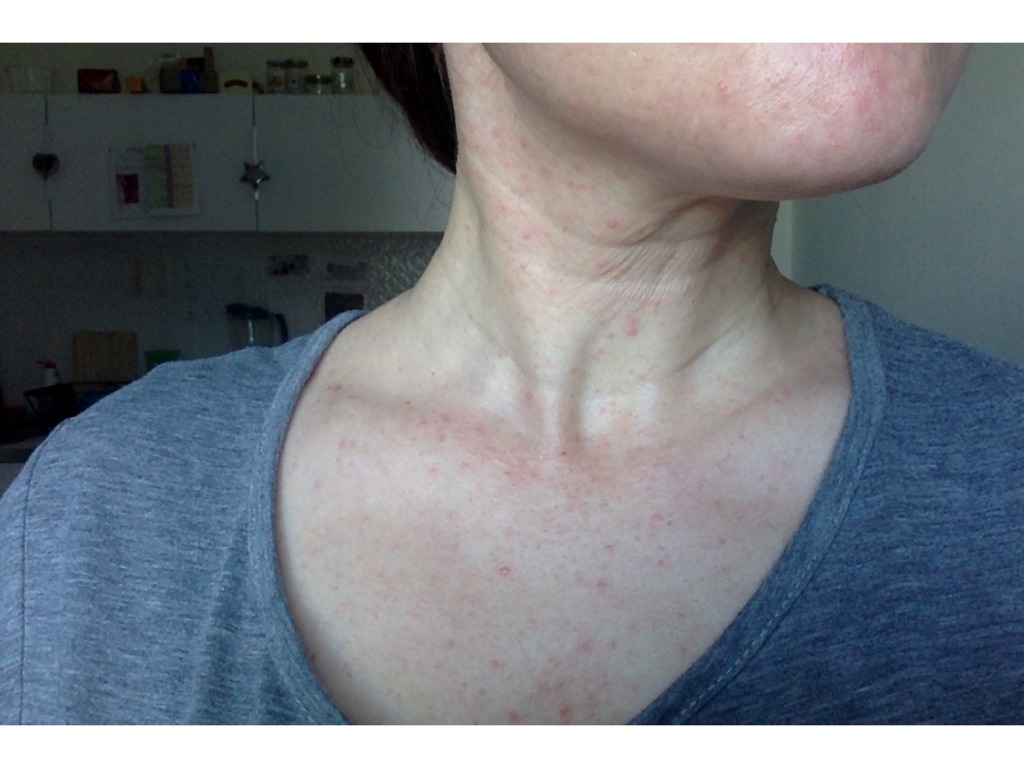 Фото 2. Как решить плохое состояние шеи?