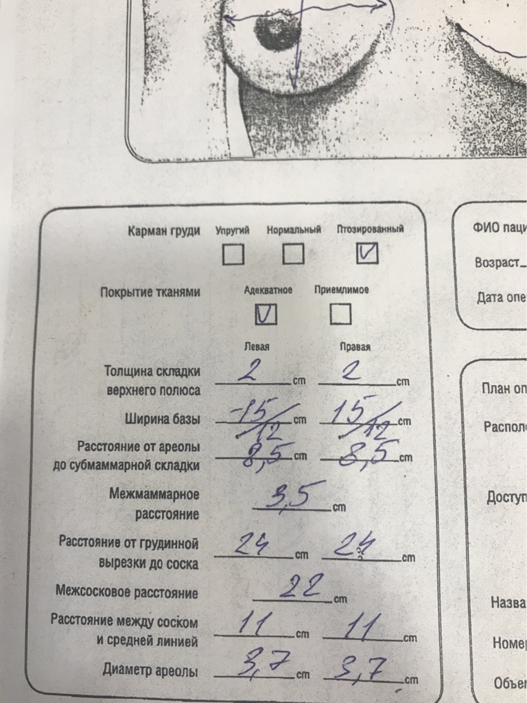 Фото 2. Посоветуйте, как можно поднять сосково-ареолярный комплекс после подтяжки груди?