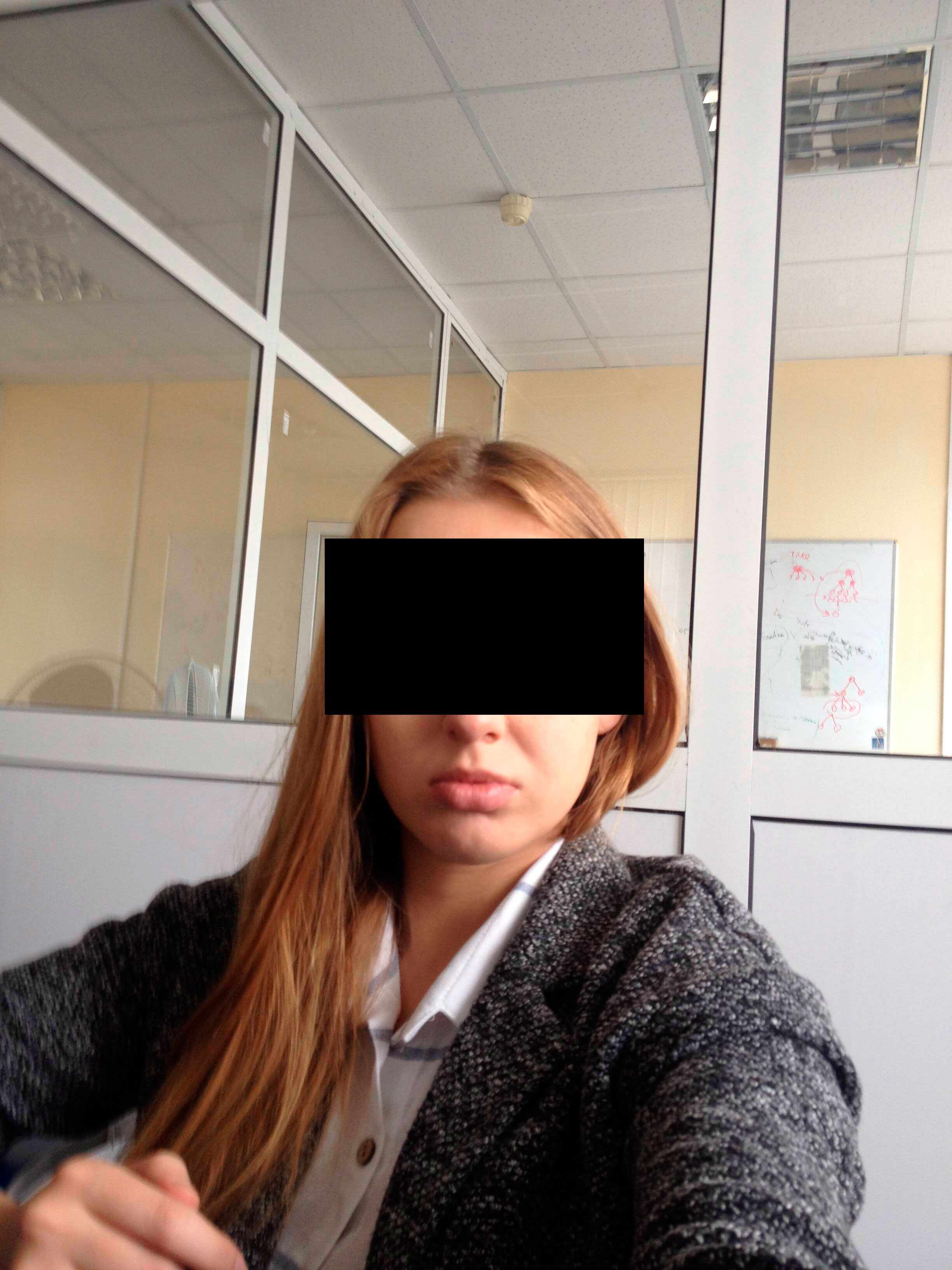 Фото 2. Как подтянуть носогубные складки?