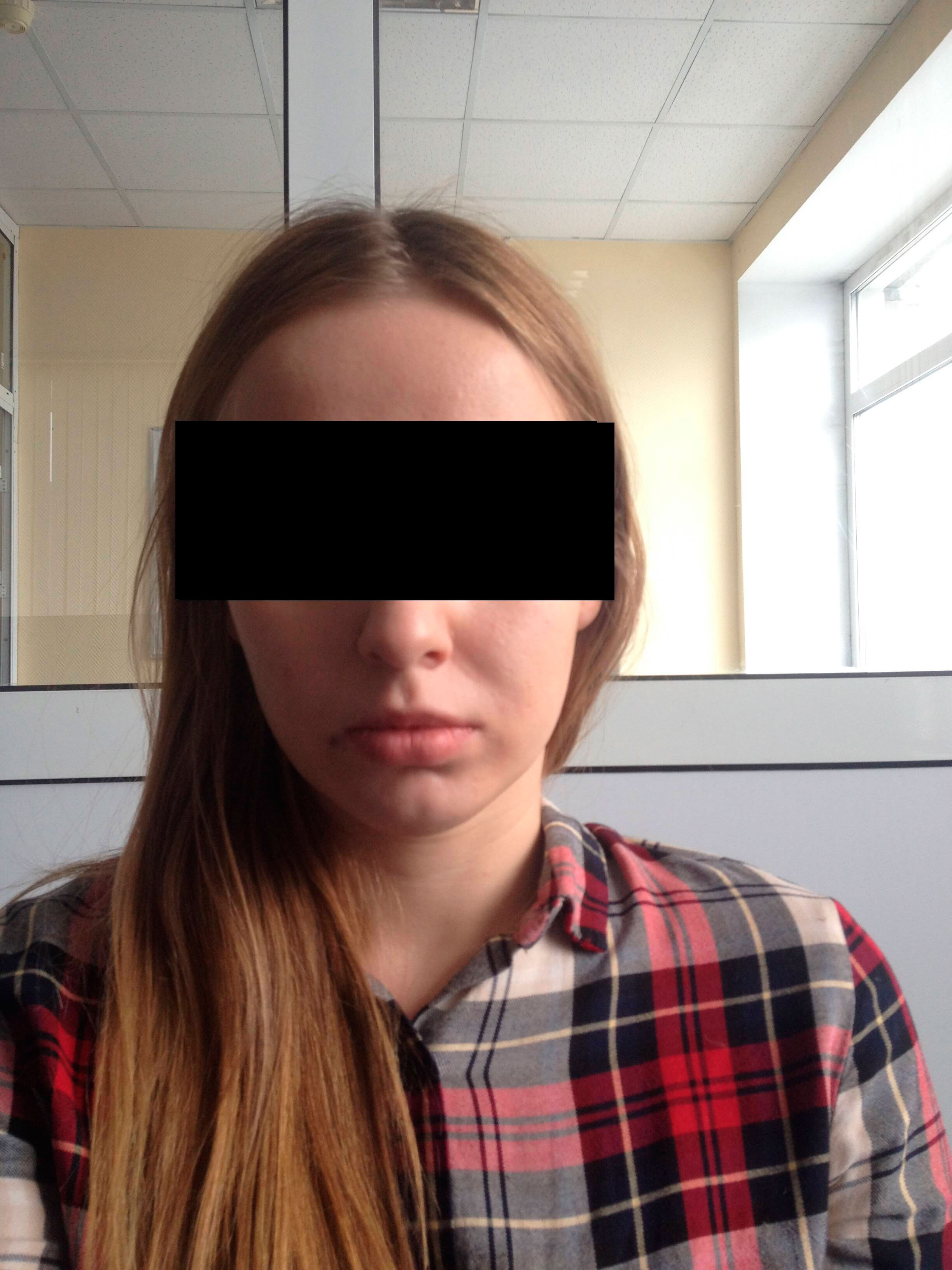 Фото 3. Как подтянуть носогубные складки?