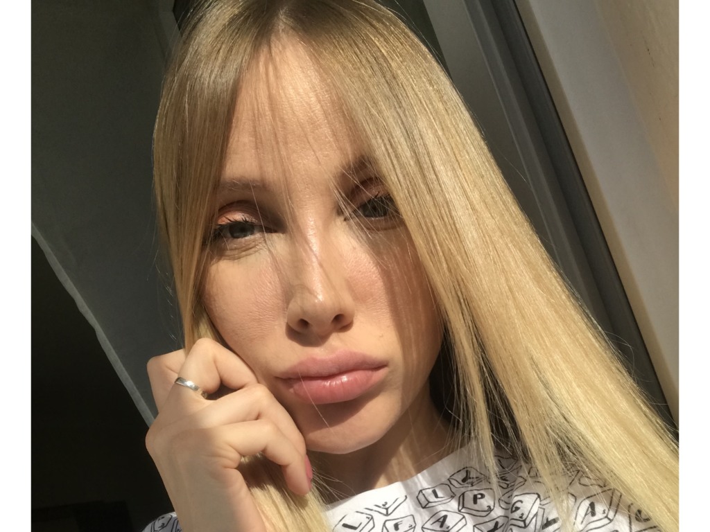 Фото 1. Поможет ли пластика век от заломов на нижних веках?