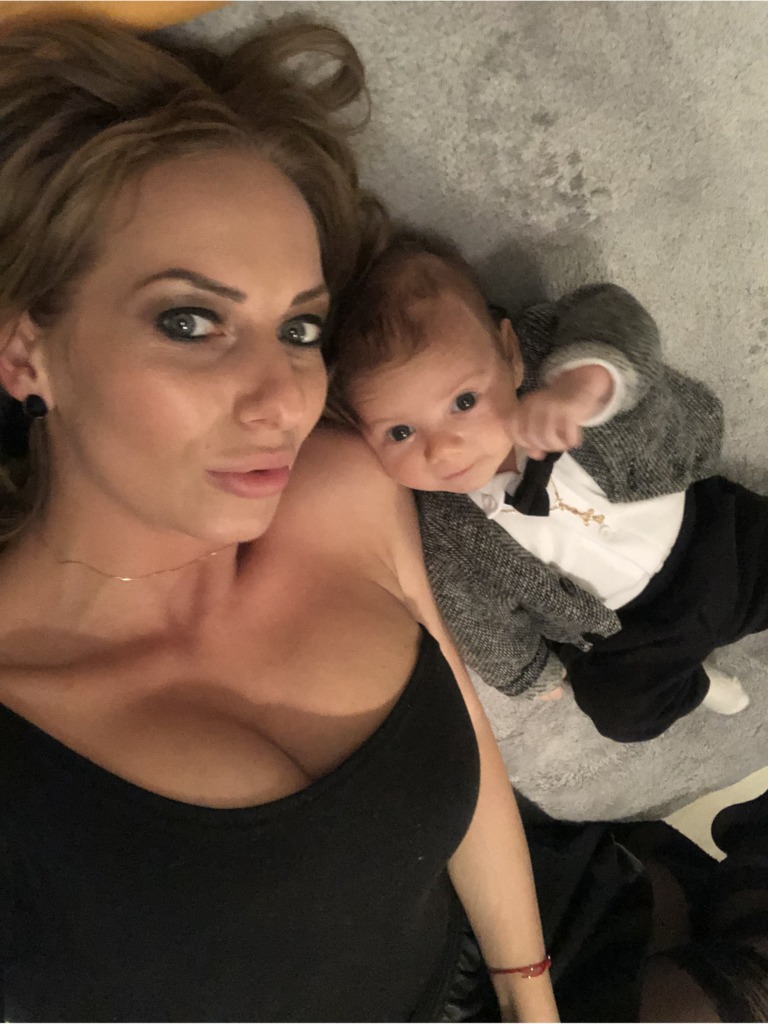 Фото 3. Сделает ли меня контурная пластика моложе? Или что-то еще?