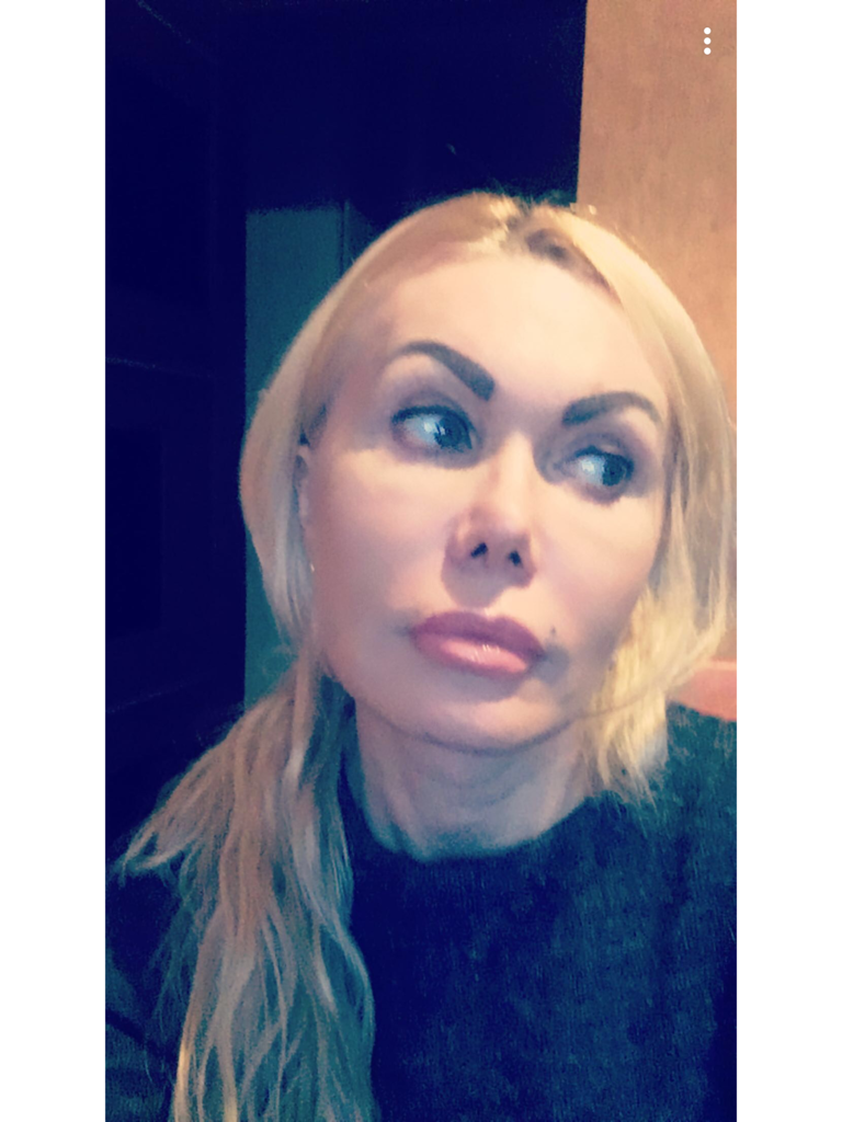 Фото 1. Возможно ли вывести Радиесс?