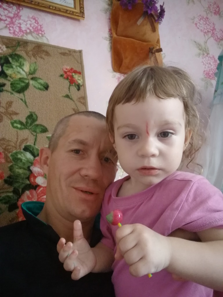 Фото 1. Как и когда лечить рубец, образовавшийся у ребенка после травмы?
