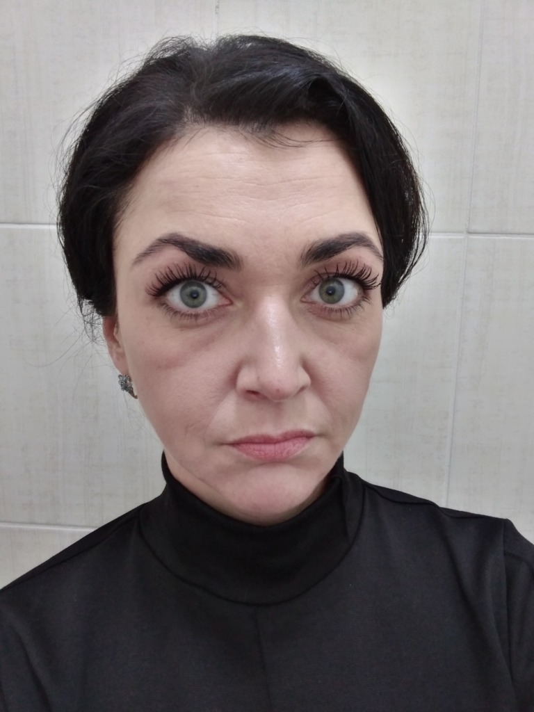 Фото 2. Каим способом убрать малярные мешки?