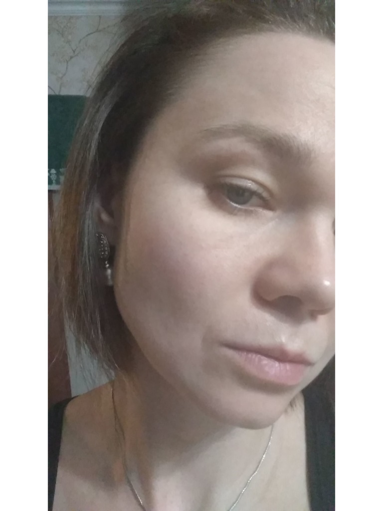 Фото 2. Почему так долго отек?