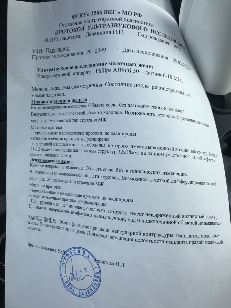 Фото 3. Что делать, если на узи разрыв импланта?