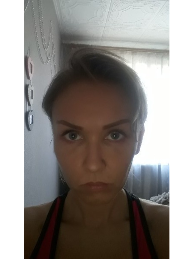 Фото 2. Как убрать синеву под глазами?