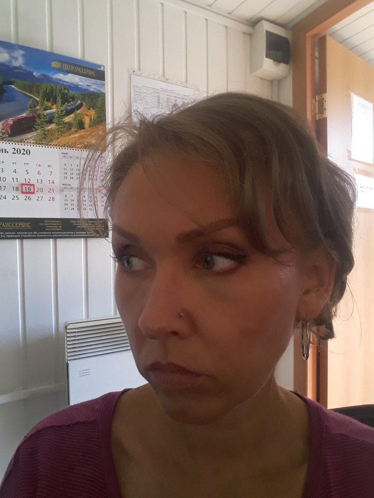 Фото 3. Как убрать синеву под глазами?