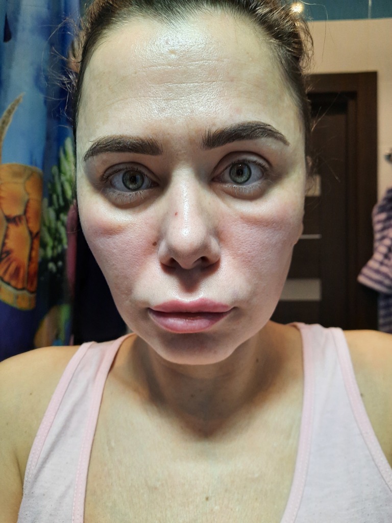 Фото 2. Это норма или воспаление?