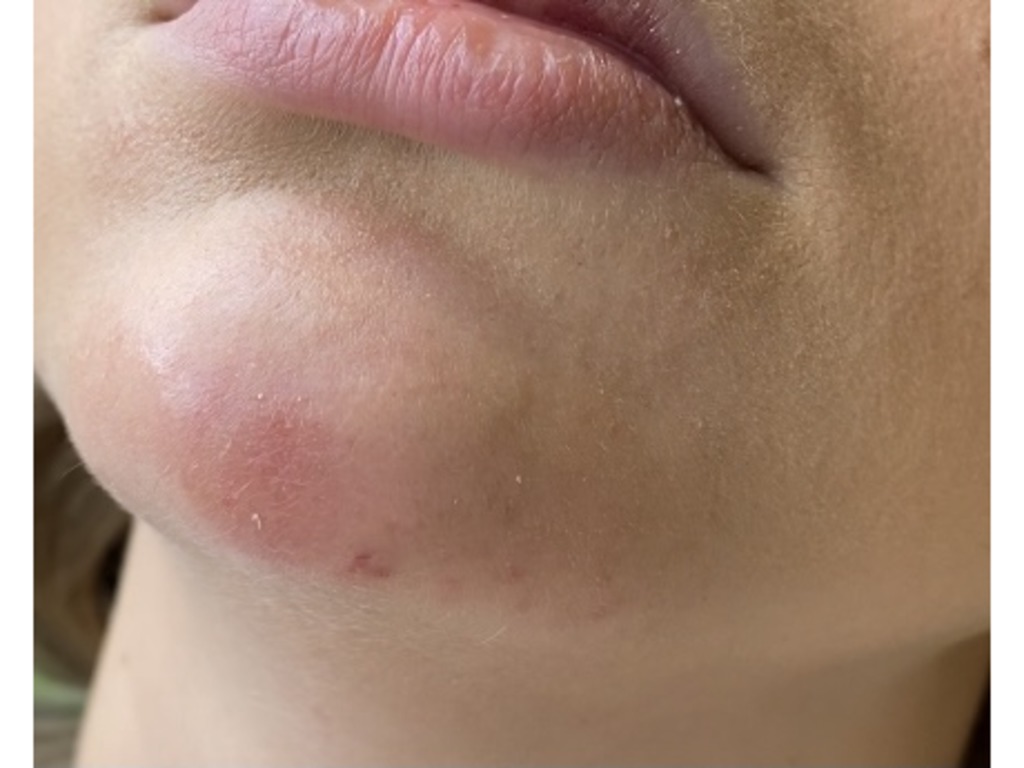 Фото 1. Нужно ли срочно к врачу, если такие симптомы?