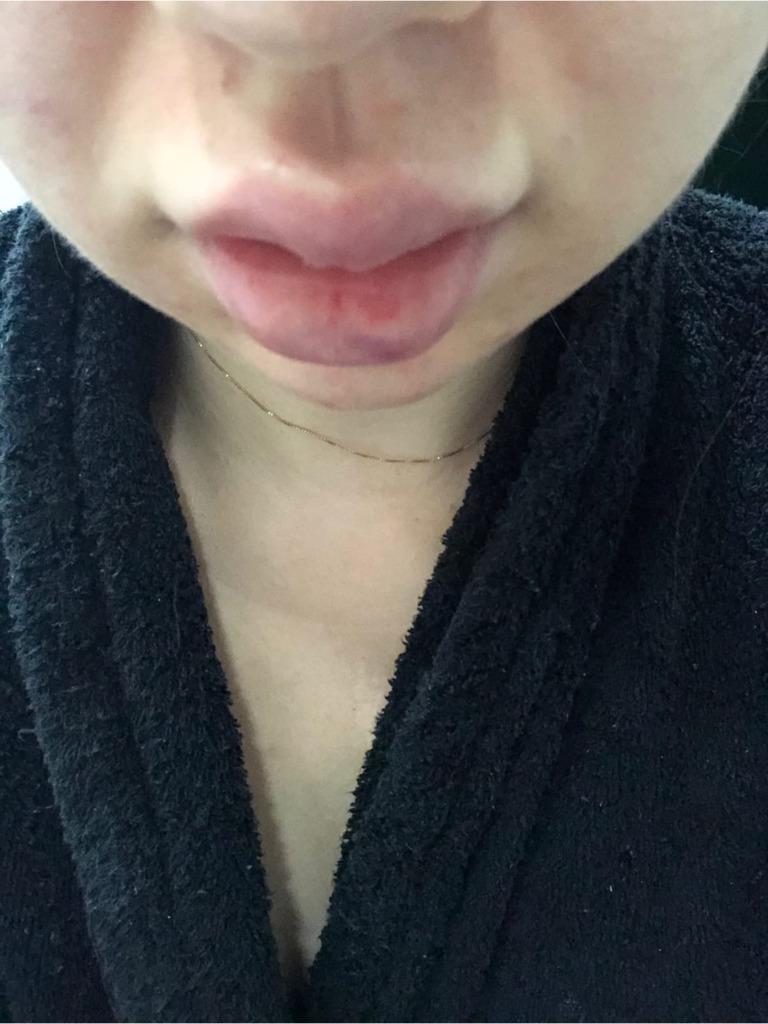 Фото 2. Беспокоит такой результат, что делать?