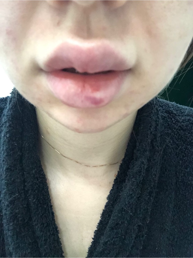 Фото 3. Беспокоит такой результат, что делать?