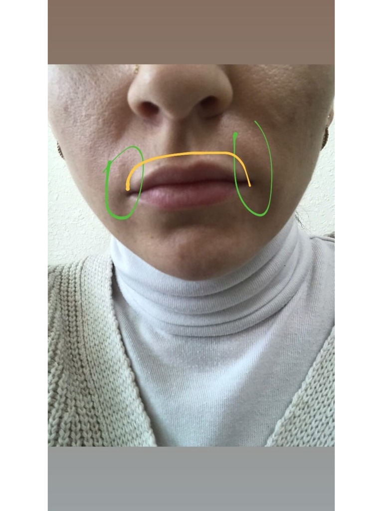 Фото 2. Как можно исправить ситуацию?